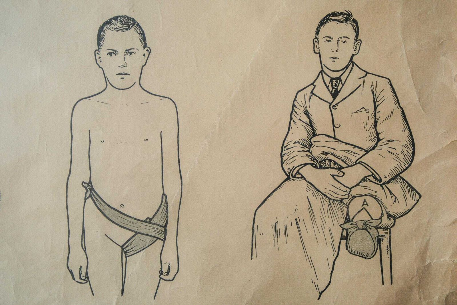 Original Anatomical Vintage British School Wall Chart Triangular Bandage Broken Bones Anatomy Wright & Sons First Aid Sling Arm Shoulder Hip photo buy