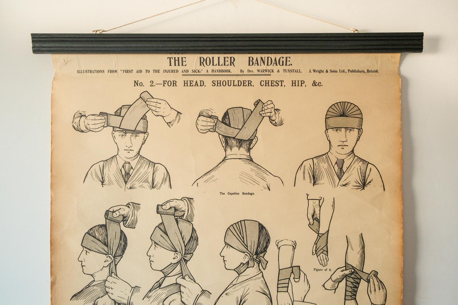 Original Anatomical Vintage British School Wall Chart Roller Head Bandage Broken Bones Anatomy Wright & Sons First Aid Shoulder Hip Chest photo furniture