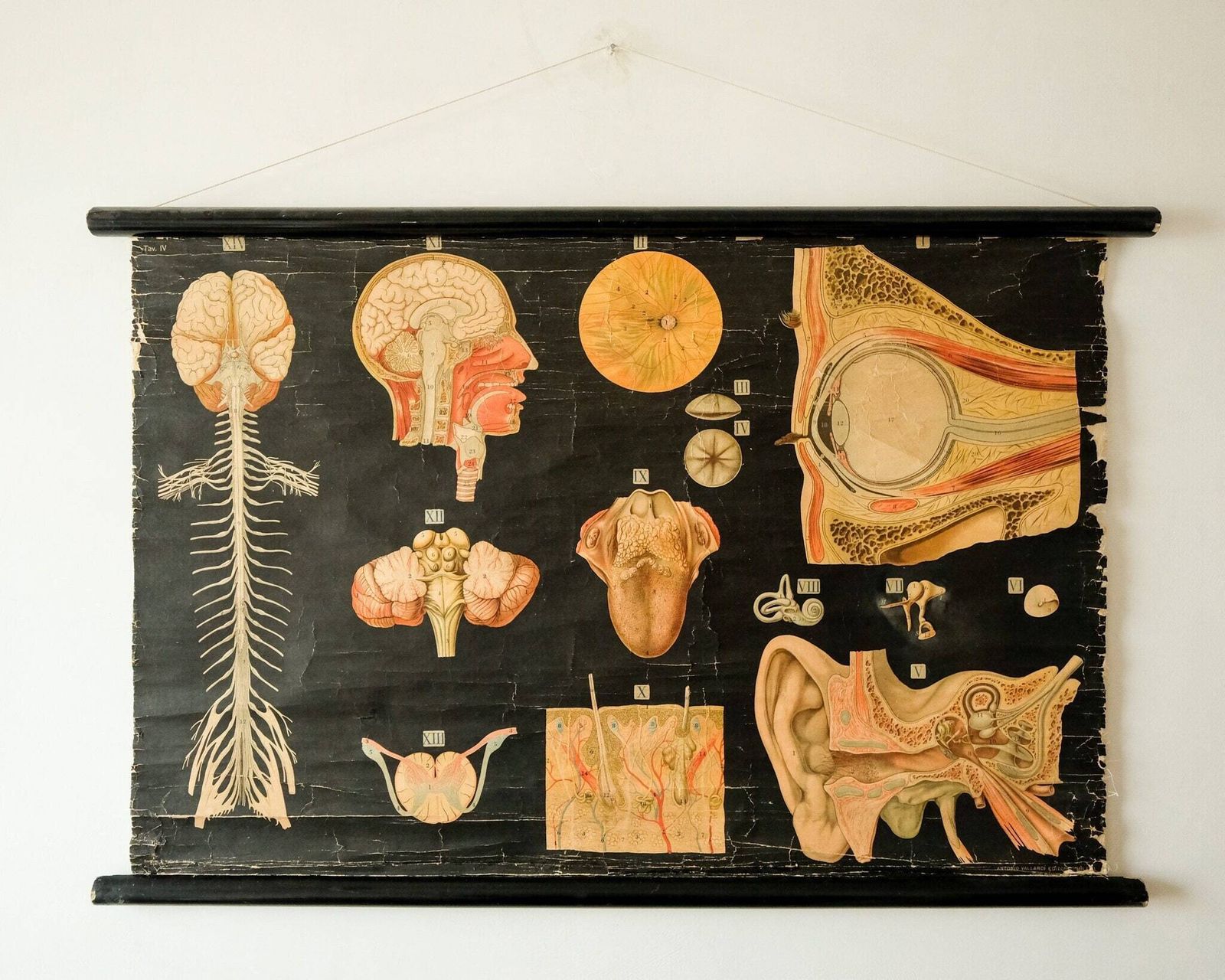 Original Anatomical Vintage Antique German Educational School Wall Chart Musculature Muscles System Skeleton Anatomy Science Beautiful Rare