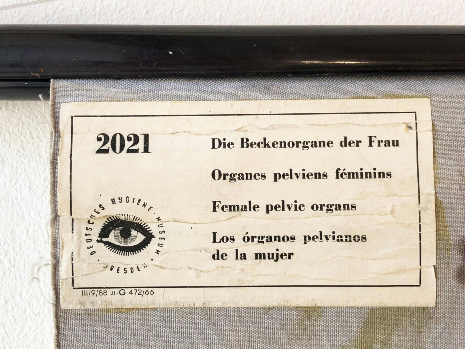 Antique Swedish School, Teaching Chart, Poster "Female Pelvic Organs" photo Art