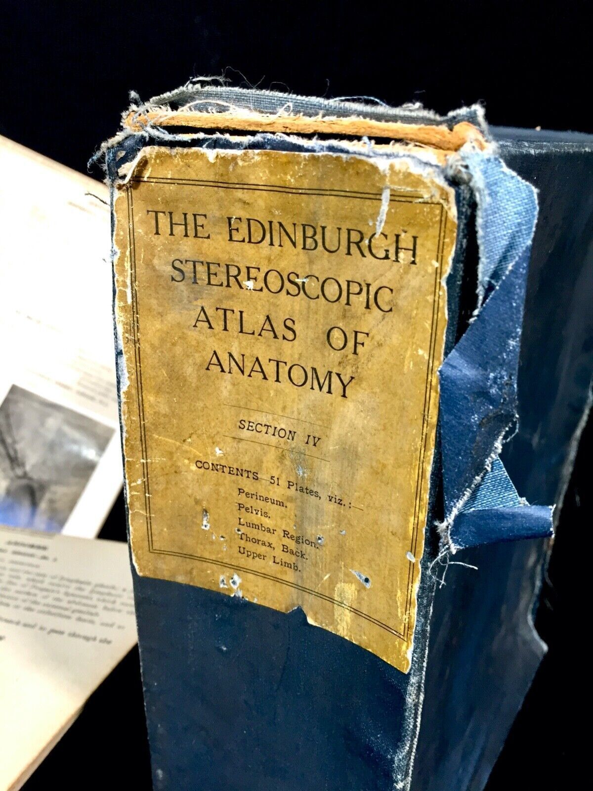 Antique Pair Of Boxed Edinburgh Stereoscopic Atlas Of Anatomy Cards Views C.1905 photo for sale