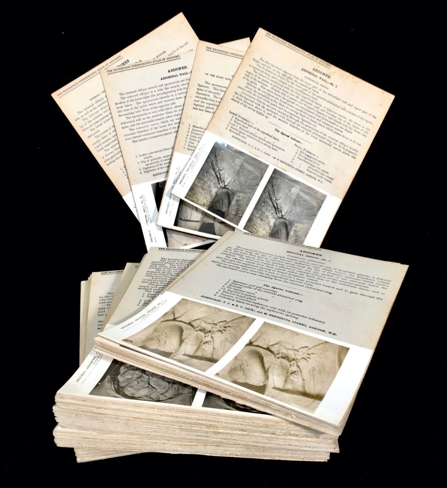 Antique Pair Of Boxed Edinburgh Stereoscopic Atlas Of Anatomy Cards Views C.1905 photo Art