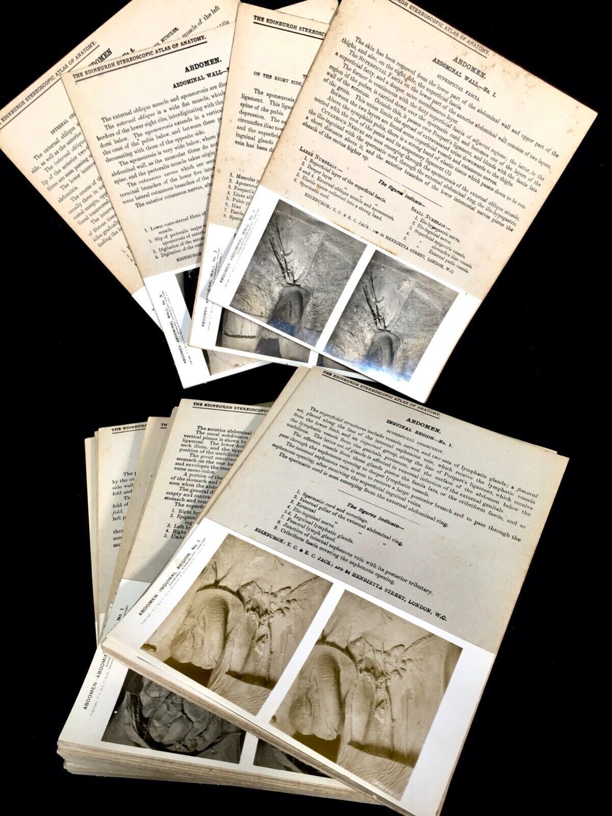 Antique Pair Of Boxed Edinburgh Stereoscopic Atlas Of Anatomy Cards Views C.1905 photo 315.0