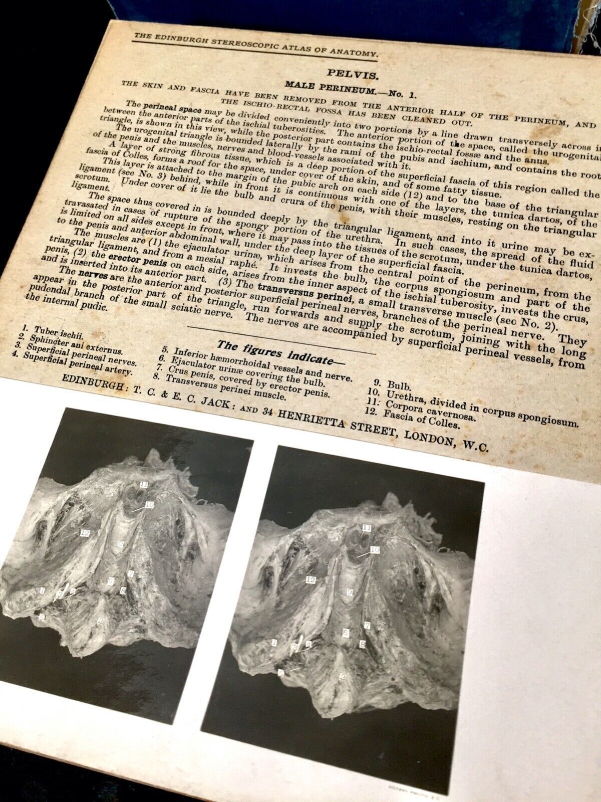 Antique Pair Of Boxed Edinburgh Stereoscopic Atlas Of Anatomy Cards Views C.1905 photo vinterior