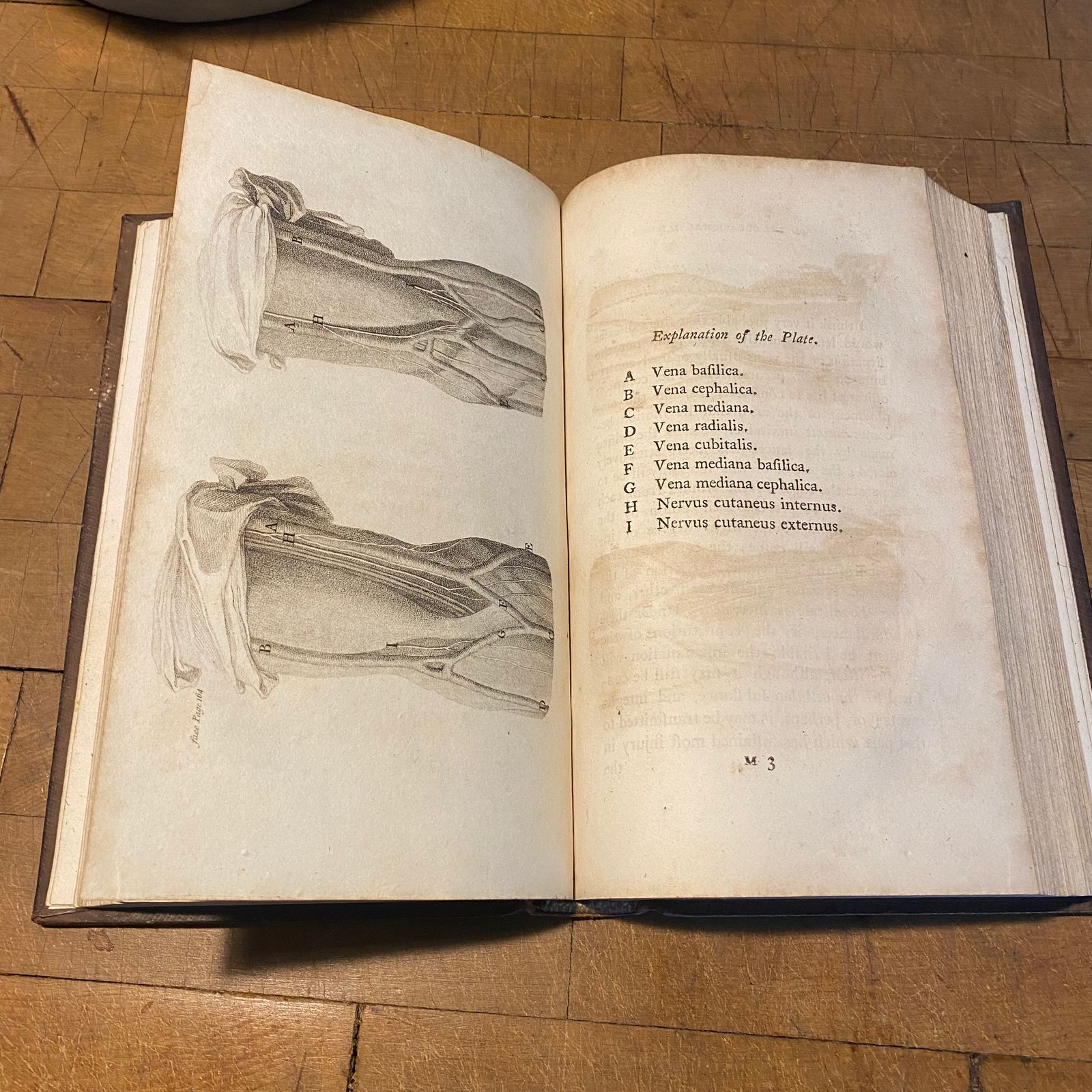 Antique 1811 Surgical Works John Abernethy Head Injuries 2nd Volume Leather Book photo furniture