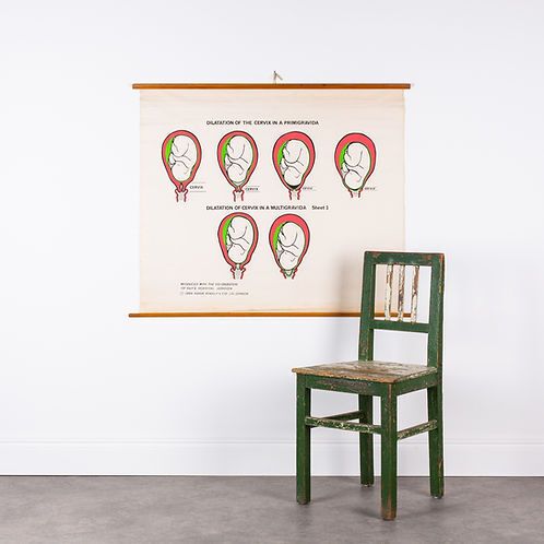 "Dilation Of The Cervix..." Adam Rouilly Medical Wall Chart photo furniture