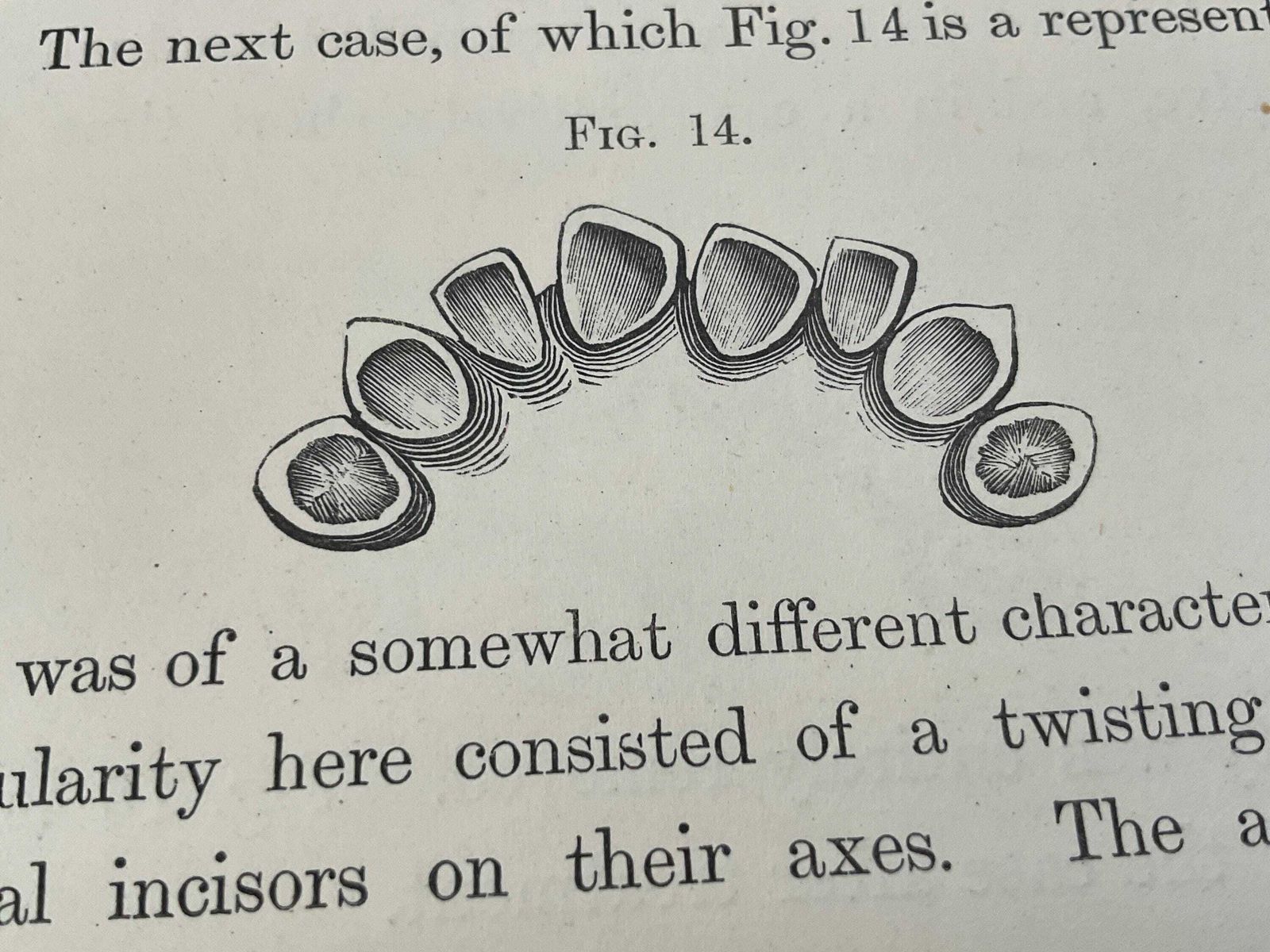 photo vinterior Antique 1870 Dental Book: Irregularities And Diseases Of The Teeth By Henry Sewill Victorian Medical History & Dental Oddities Decor