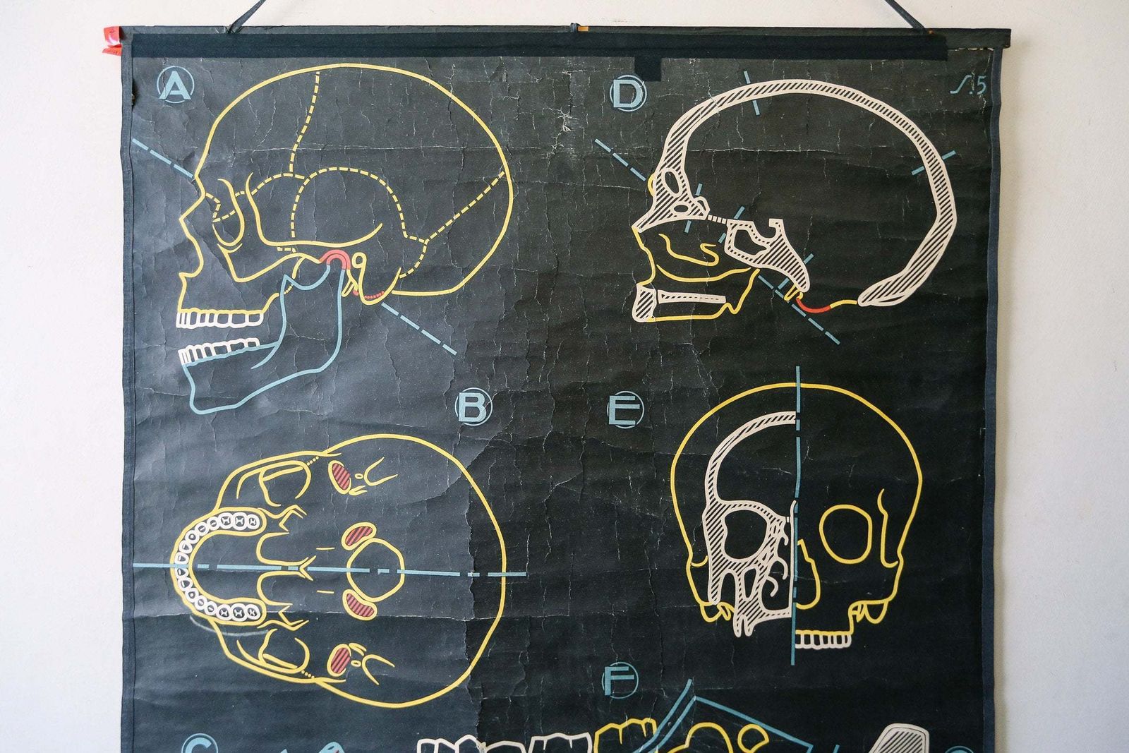 Original Anatomical Vintage Mid Century French School Chalk Wall Chart Skull Teeth Dentition Dentistry Dental Anatomy Rare DR Auzoux Sougy photo for sale