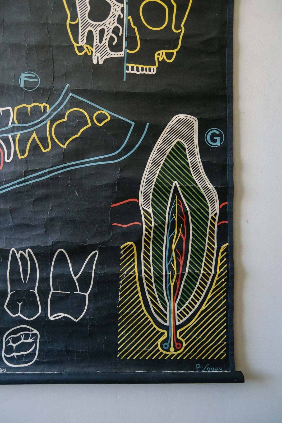 Original Anatomical Vintage Mid Century French School Chalk Wall Chart Skull Teeth Dentition Dentistry Dental Anatomy Rare DR Auzoux Sougy photo 175.0