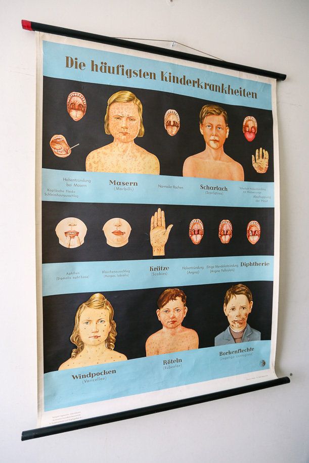 Original Anatomical Vintage German School Wall Chart Childhood Diseases Measles Chicken Pox Anatomy Medicine Science Beautiful Rare photo furniture