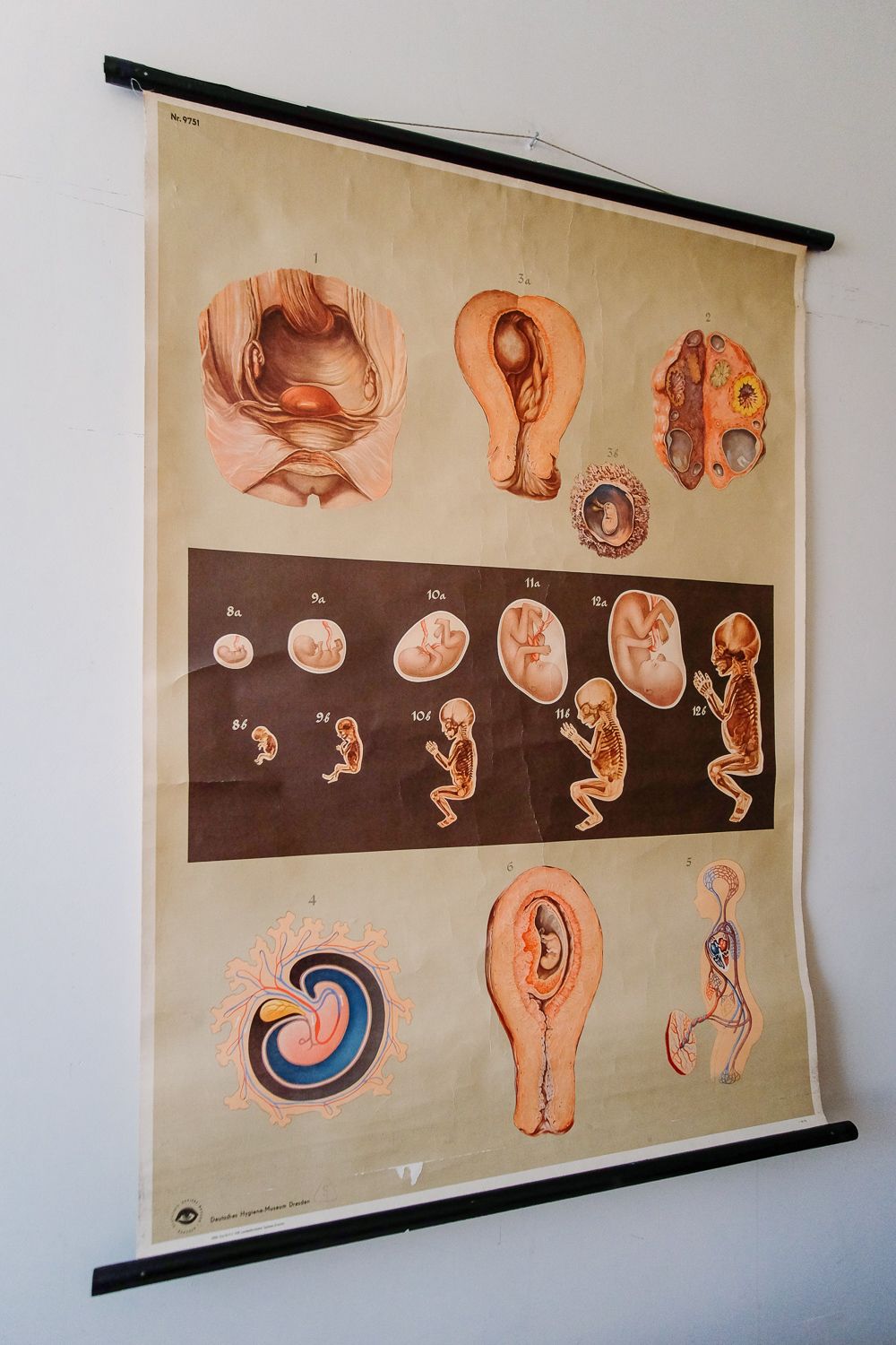 Original Anatomical Vintage German Educational School Wall Chart Gestation Foetus Development Birth Human Deutsches Science Museum Rare photo 135.0