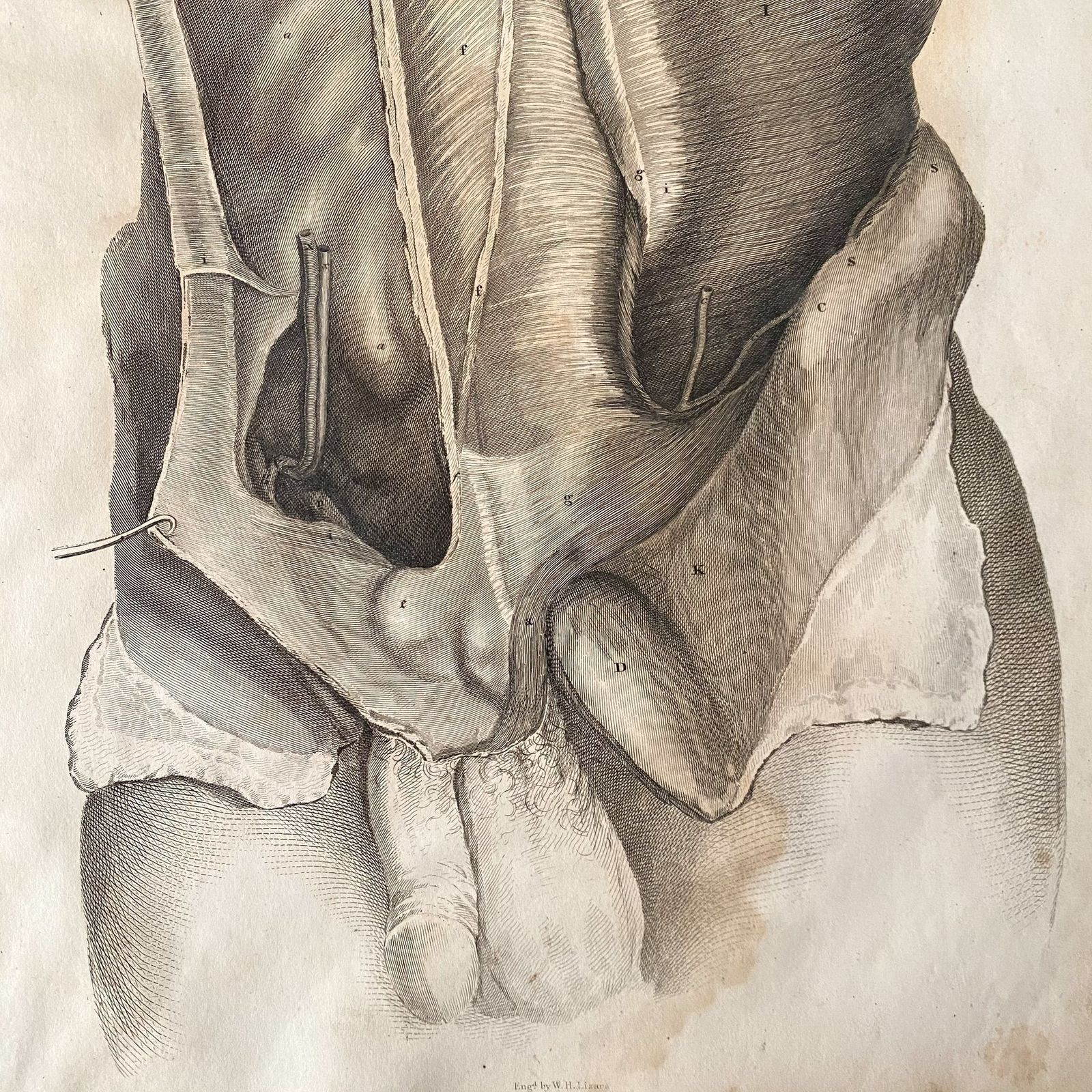 Anatomical Male Lower Body 1, Lizars 1824 'System Of Anatomical Plates'