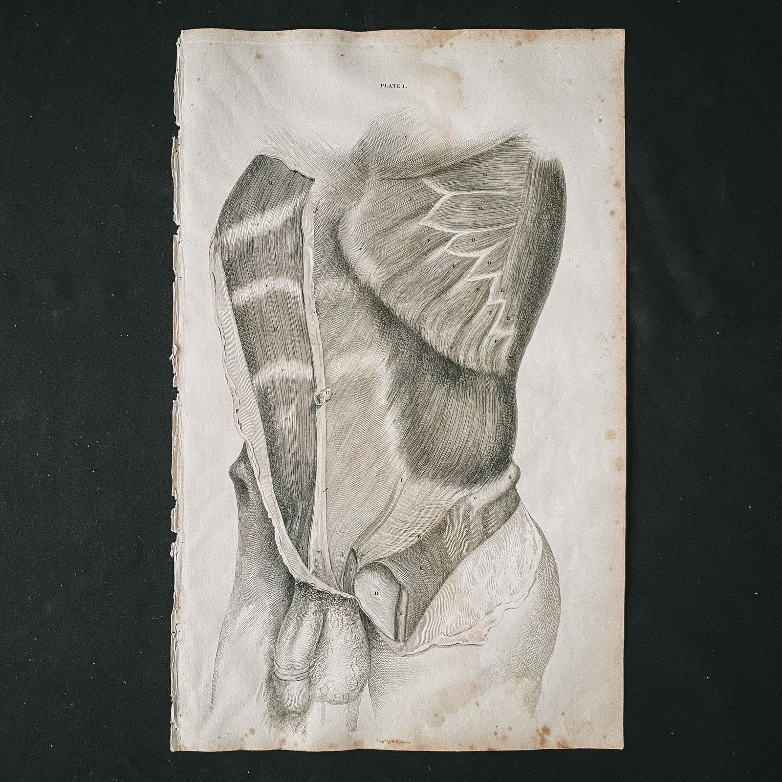 Anatomical Male Lower Body 2, Lizars 1824 'System Of Anatomical Plates' photo furniture