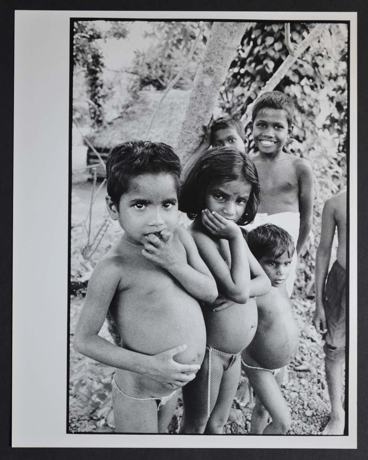 Rolf Gillhausen Undernourished Children In India, 1950s   1960s. 1960 1969