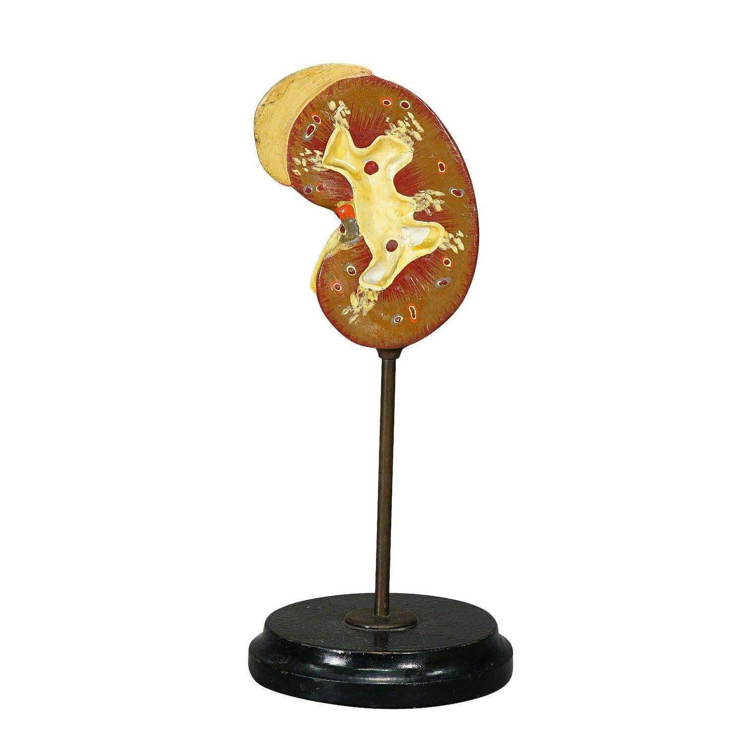 Antique Teaching Model Longitudinal Profile Of The Kidney, Ca. 1900