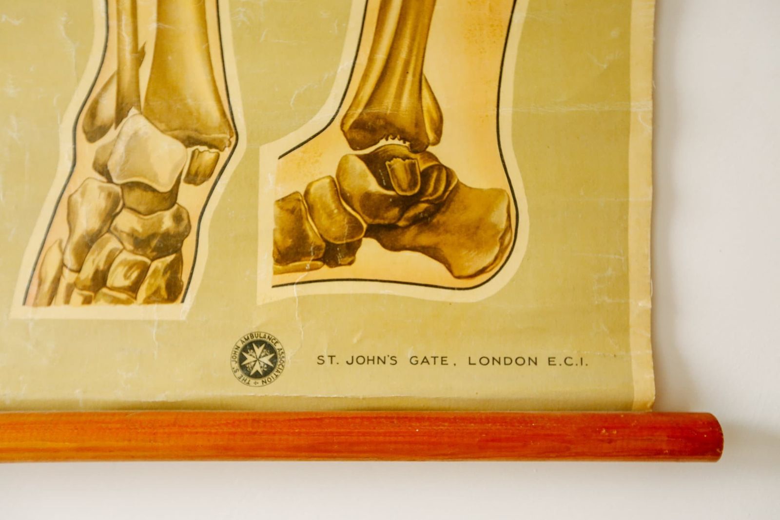 Original Anatomical Vintage British Educational School Wall Chart Bone Fractures Breaks Medicine St John's Ambulance Teck photo furniture