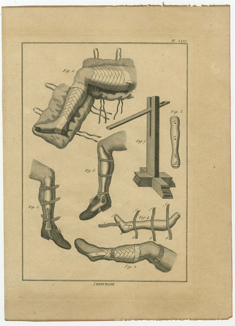 Original Antique Print Of Leg Surgery Techniques
