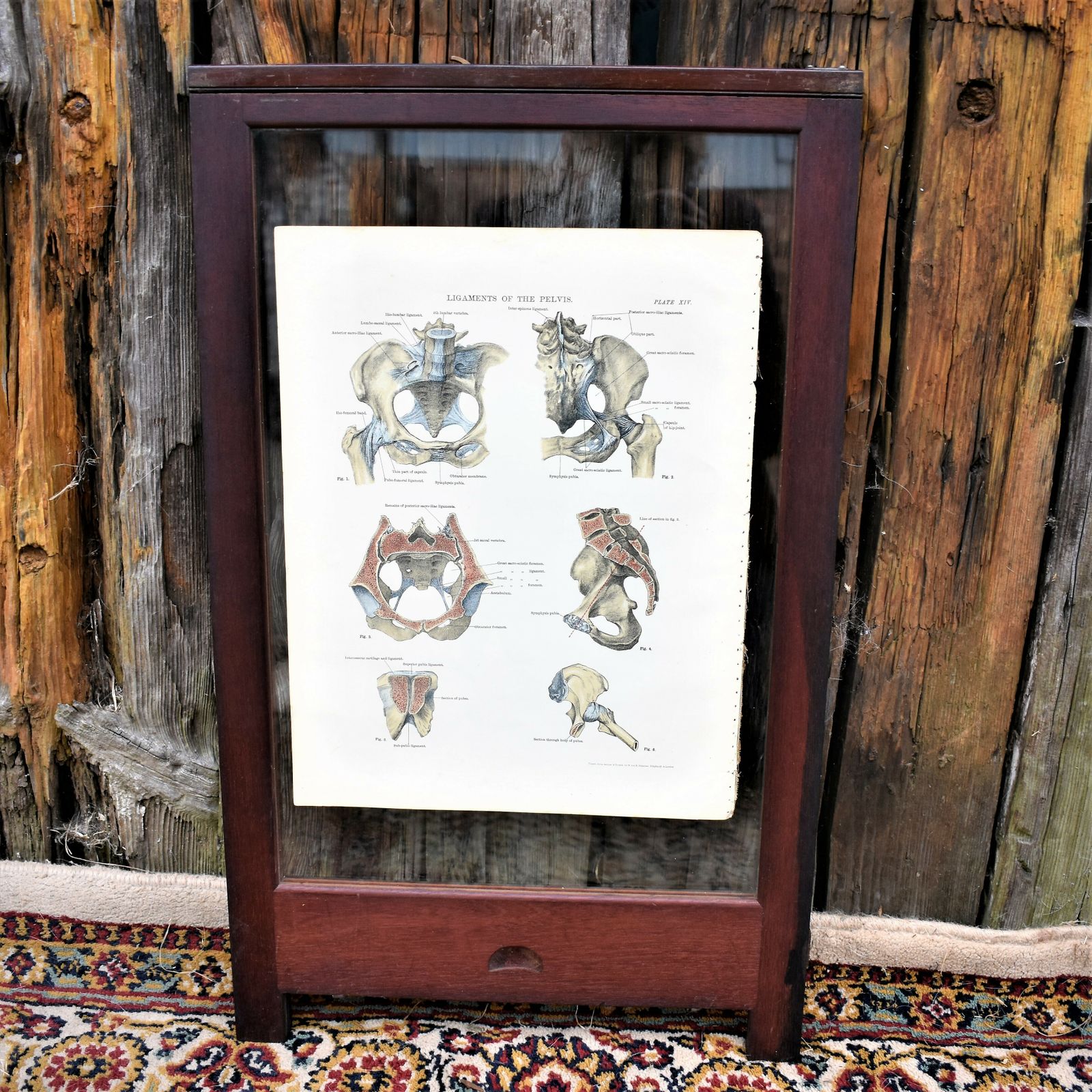 Antique 1885 W & Ak Johnston Human Pelvis Thorax Plate Print Museum Frame Pair photo for sale