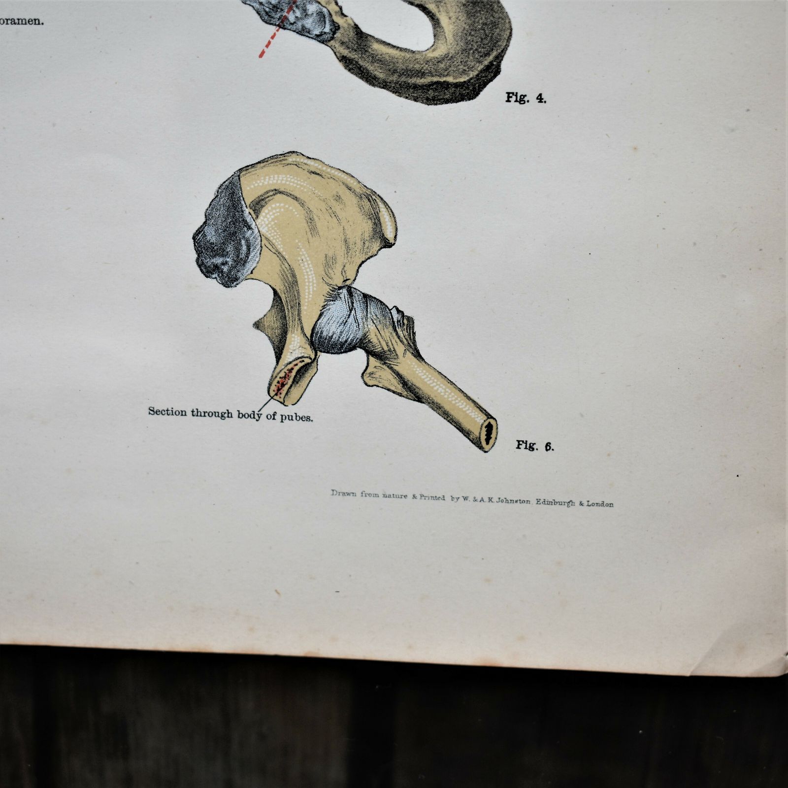 Antique 1885 W & Ak Johnston Human Pelvis Thorax Plate Print Museum Frame Pair photo vinterior