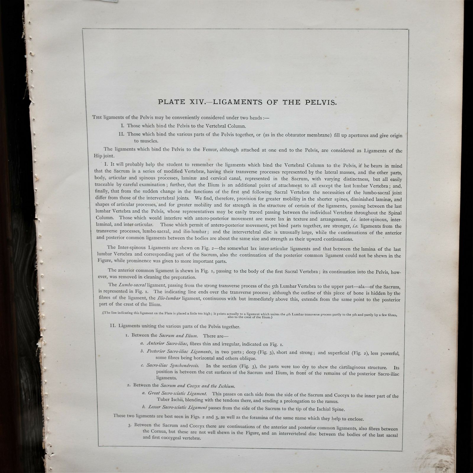 photo buy Antique 1885 W & Ak Johnston Human Pelvis Thorax Plate Print Museum Frame Pair