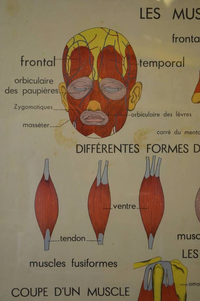 Mid Century French Medical Poster photo Art