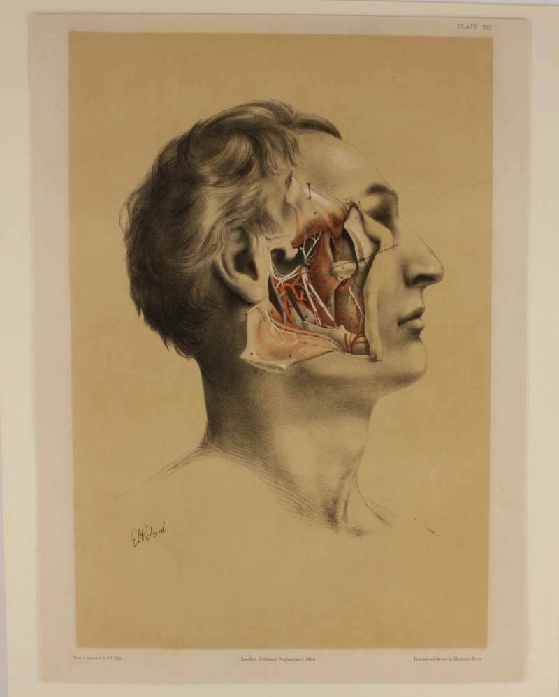 G Ellis 1864 Illustration Of Dissection The Face. Anatomy Lithograph photo for sale