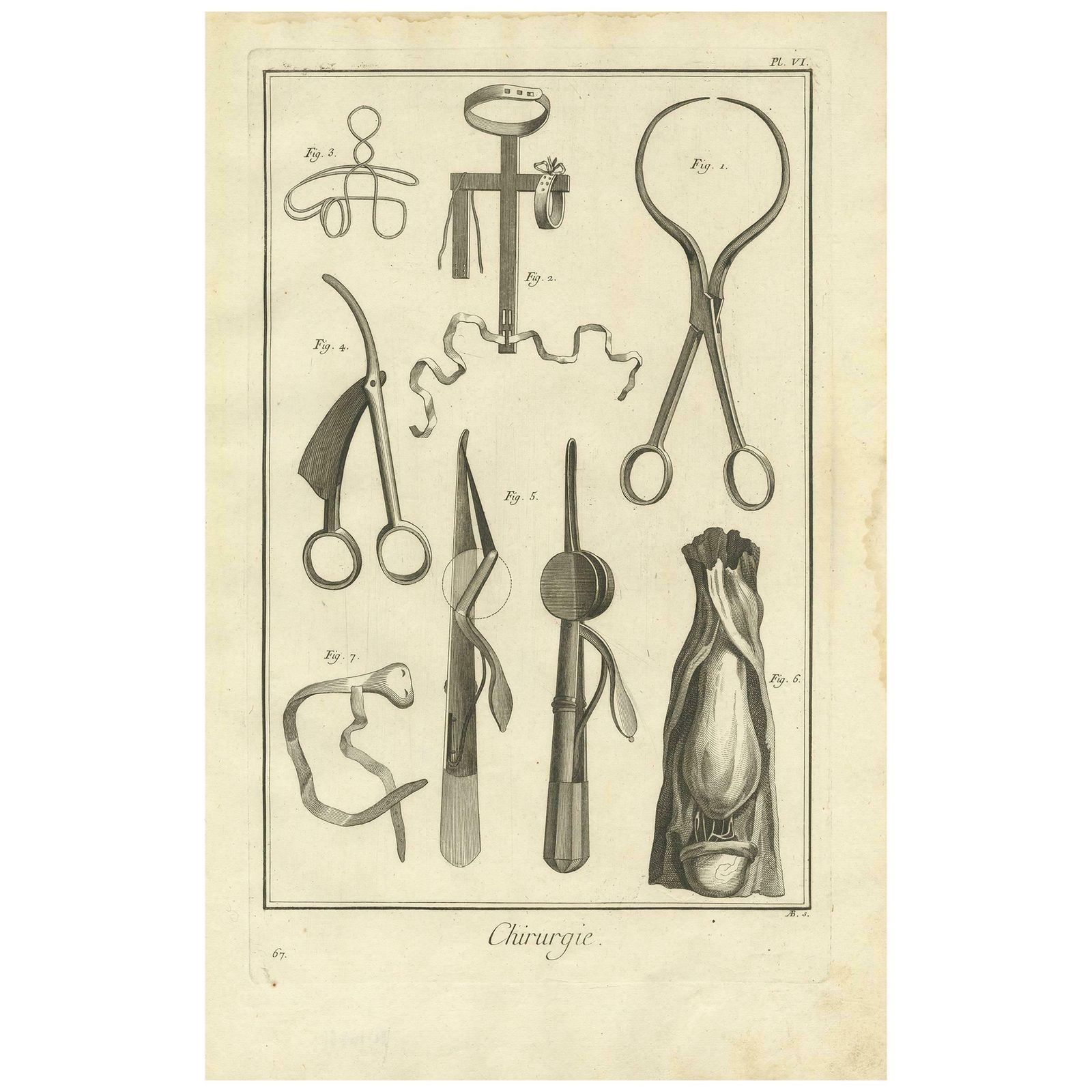 Antique Medical Print 'Pl. VI' By D. Diderot, Circa 1760