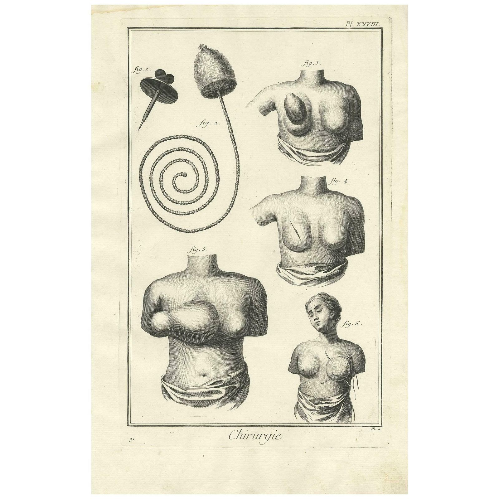 Antique Medical Print 'Pl. Xxviii' By D. Diderot, Circa 1760