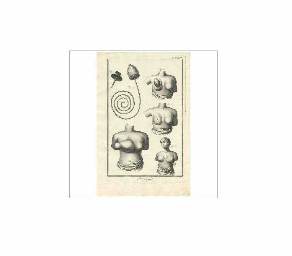 Antique Medical Print 'Pl. Xxviii' By D. Diderot, Circa 1760 photo Art