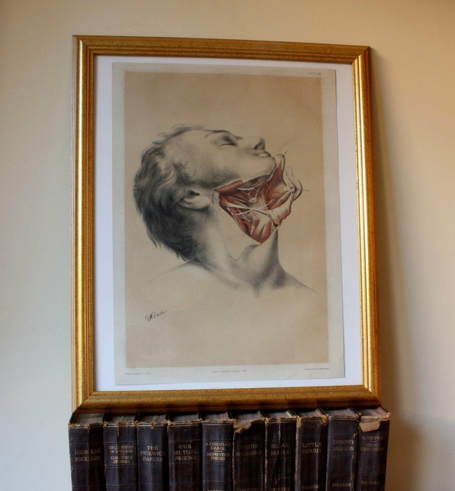 photo for sale Illustration Of Dissection Of Throat. Anatomy Lithograph. G Ellis 1864.