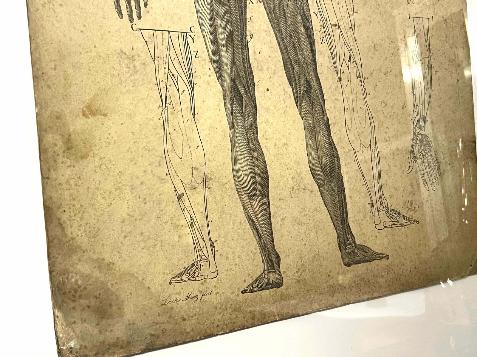 DR Munz Fecit, A 19th Century Anatomical Etching photo Art