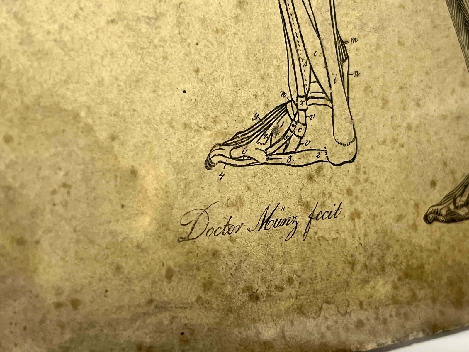 DR Munz Fecit, A 19th Century Anatomical Etching photo 153.0