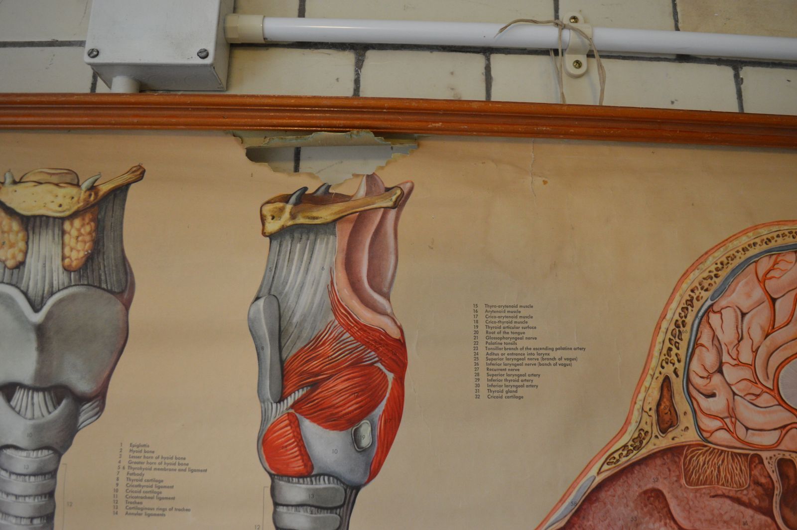Early To Mid 20th Century Medical Anatomical Chart Showing Head And Throat photo Art