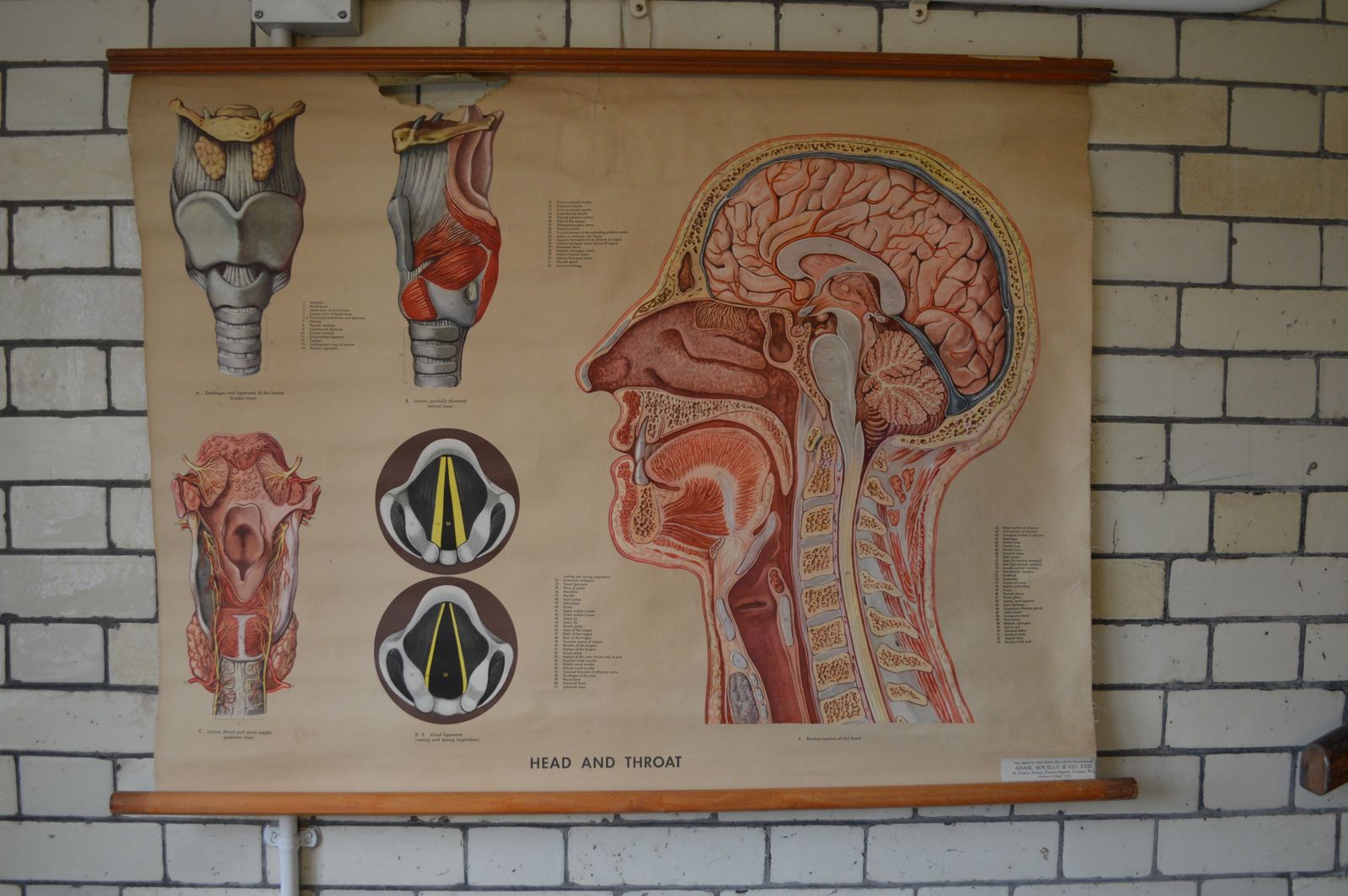 Early To Mid 20th Century Medical Anatomical Chart Showing Head And Throat
