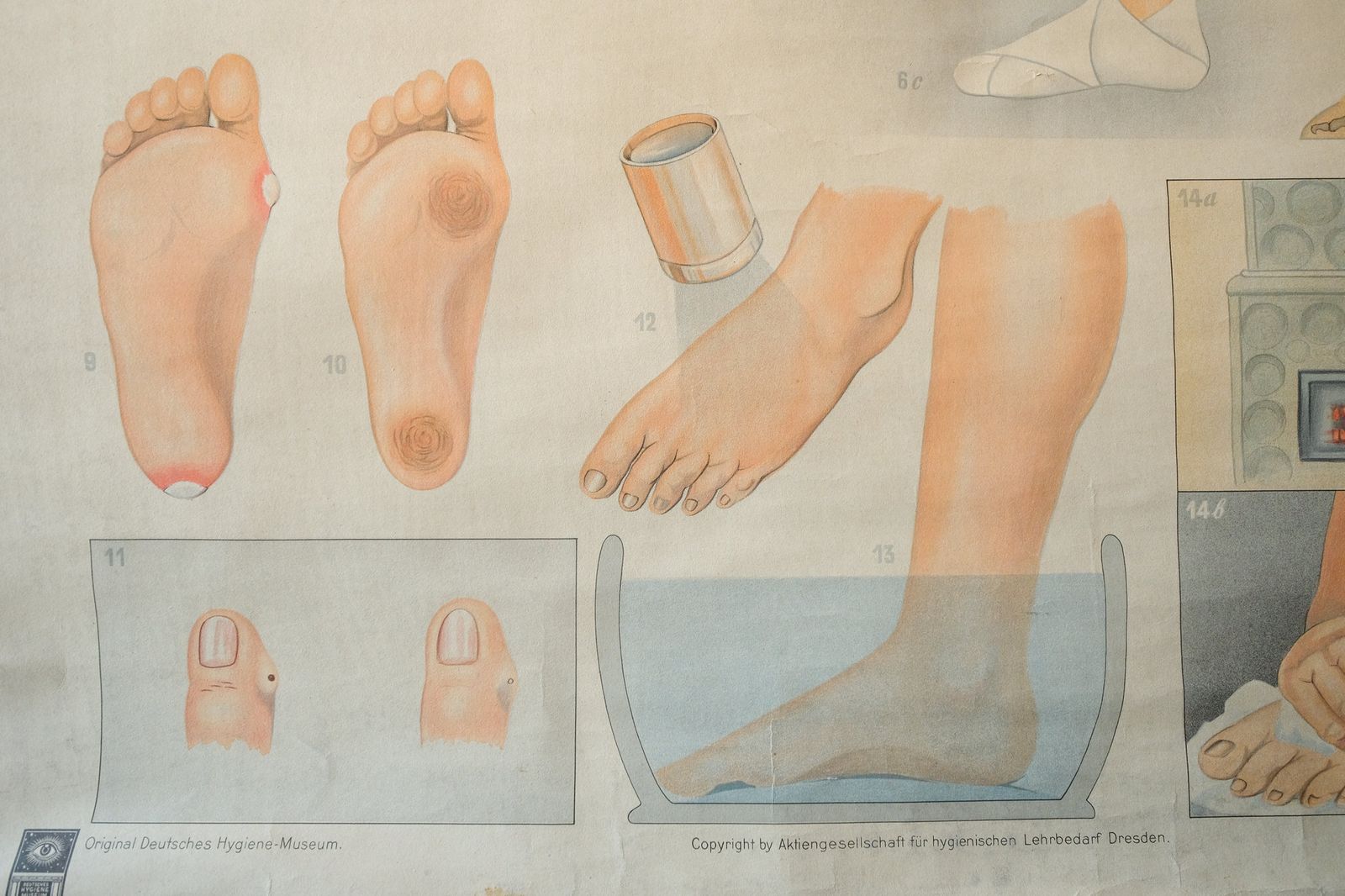 Original Anatomical Vintage German Educational School Wall Chart Foot Care Feet Bones Anatomy Medicine Deutsches Science Museum Rare photo vinterior