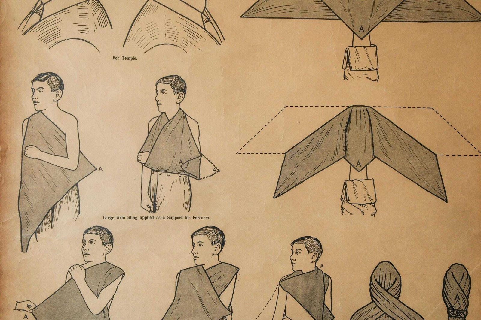 Original Anatomical Vintage British School Wall Chart Triangular Bandage Broken Bones Anatomy Wright & Sons First Aid Sling photo for sale