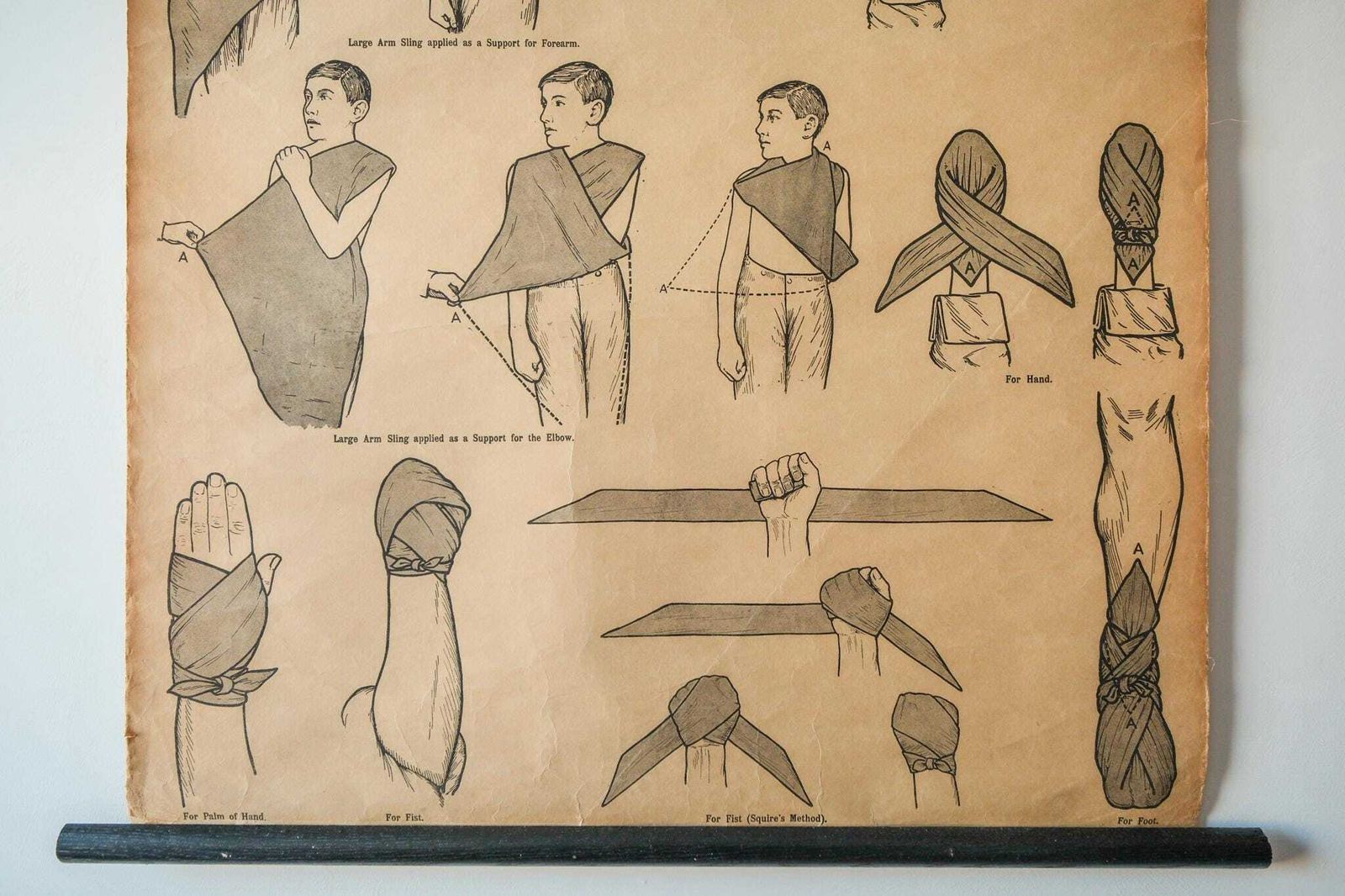 Original Anatomical Vintage British School Wall Chart Triangular Bandage Broken Bones Anatomy Wright & Sons First Aid Sling photo Art