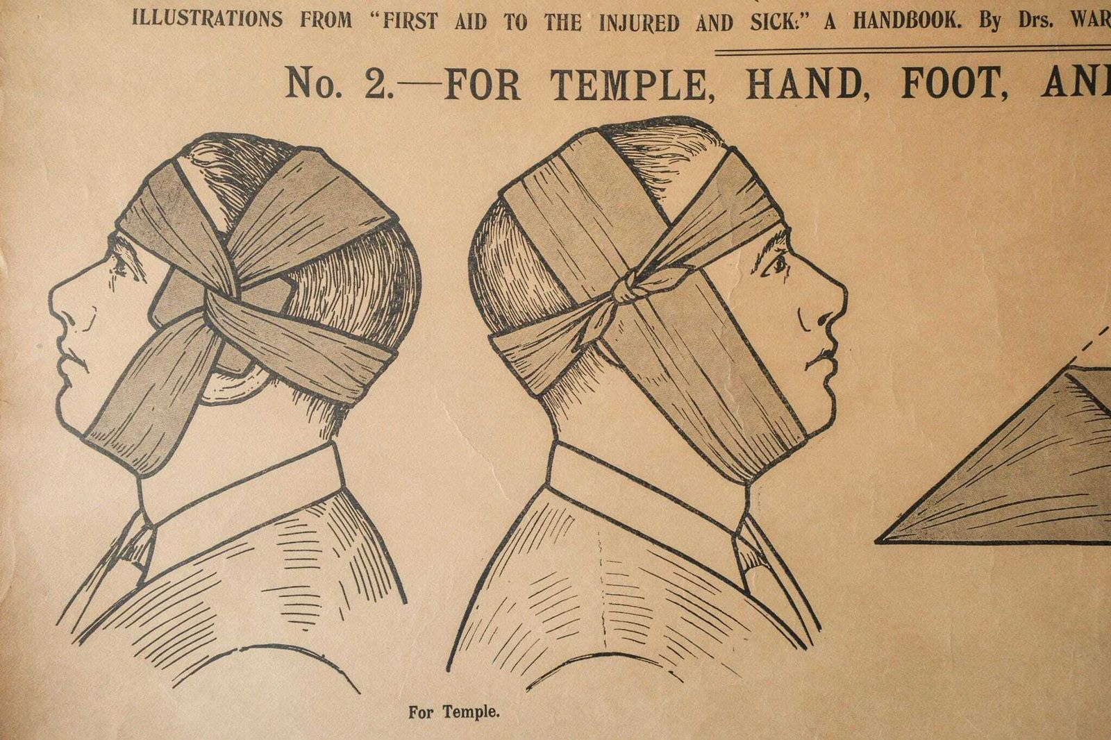 Original Anatomical Vintage British School Wall Chart Triangular Bandage Broken Bones Anatomy Wright & Sons First Aid Sling photo 171.0