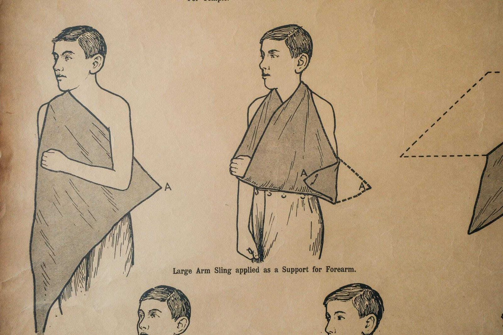 Original Anatomical Vintage British School Wall Chart Triangular Bandage Broken Bones Anatomy Wright & Sons First Aid Sling photo vinterior