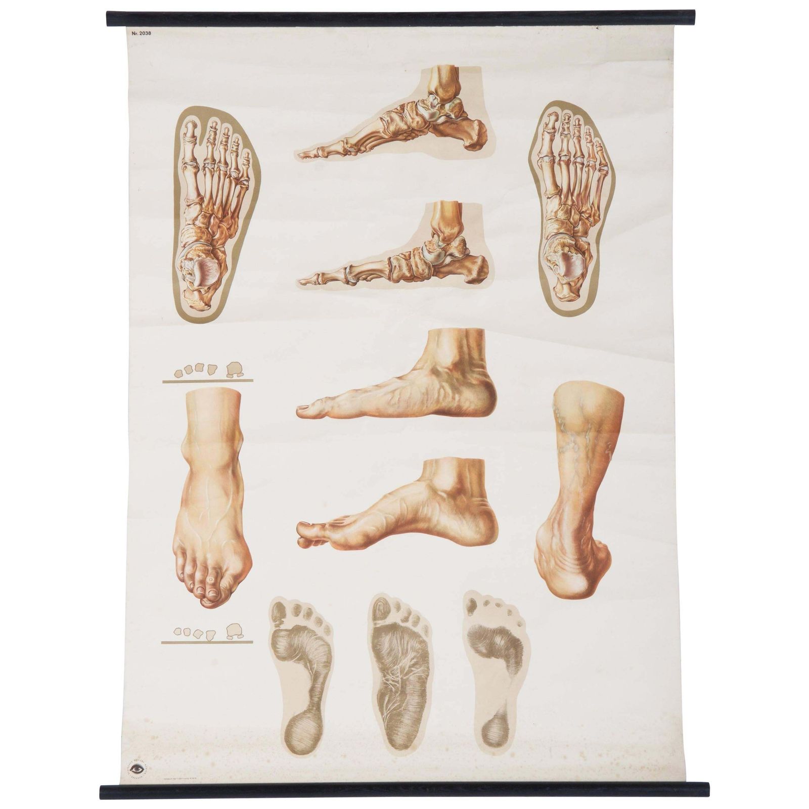 Vintage Groot Duits Medisch Schoolplaat, Poster "Orthopedics Of Foot"