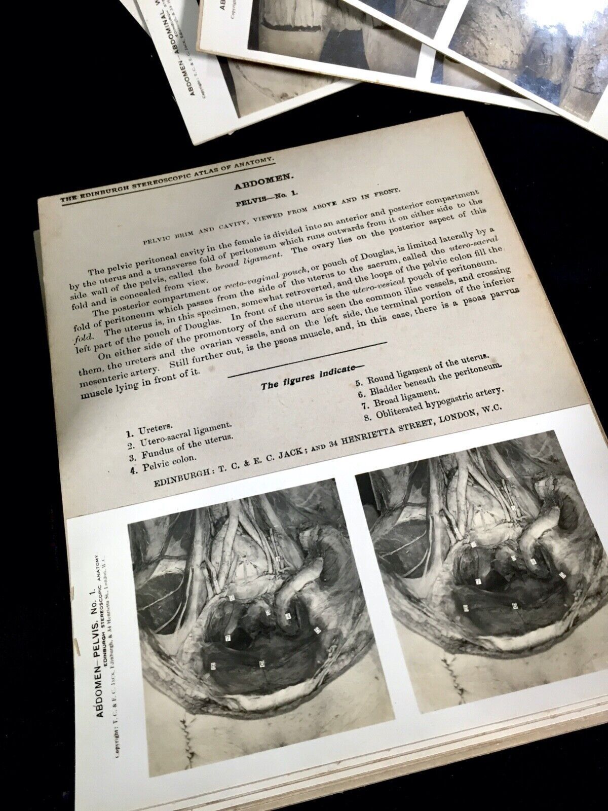Antique Pair Of Boxed Edinburgh Stereoscopic Atlas Of Anatomy Cards Views C.1905 photo buy