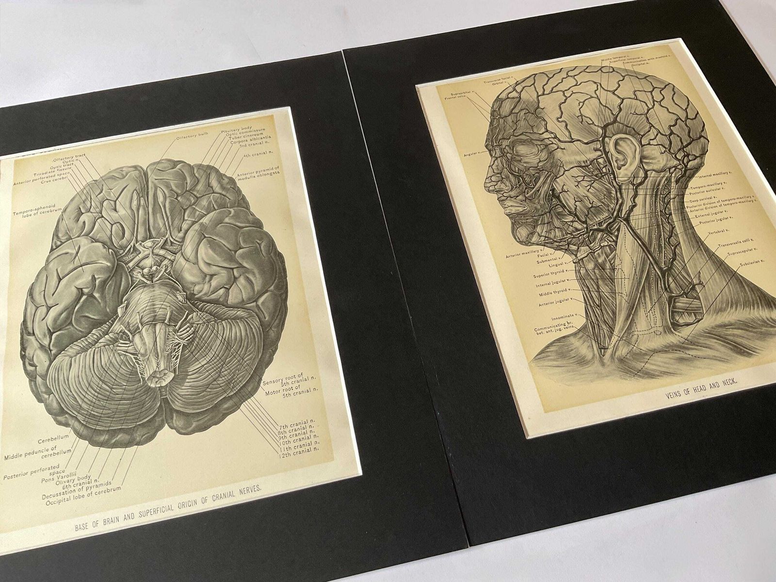 Antieke anatomische gravures uit 1900. Wanddecoratie. photo furniture