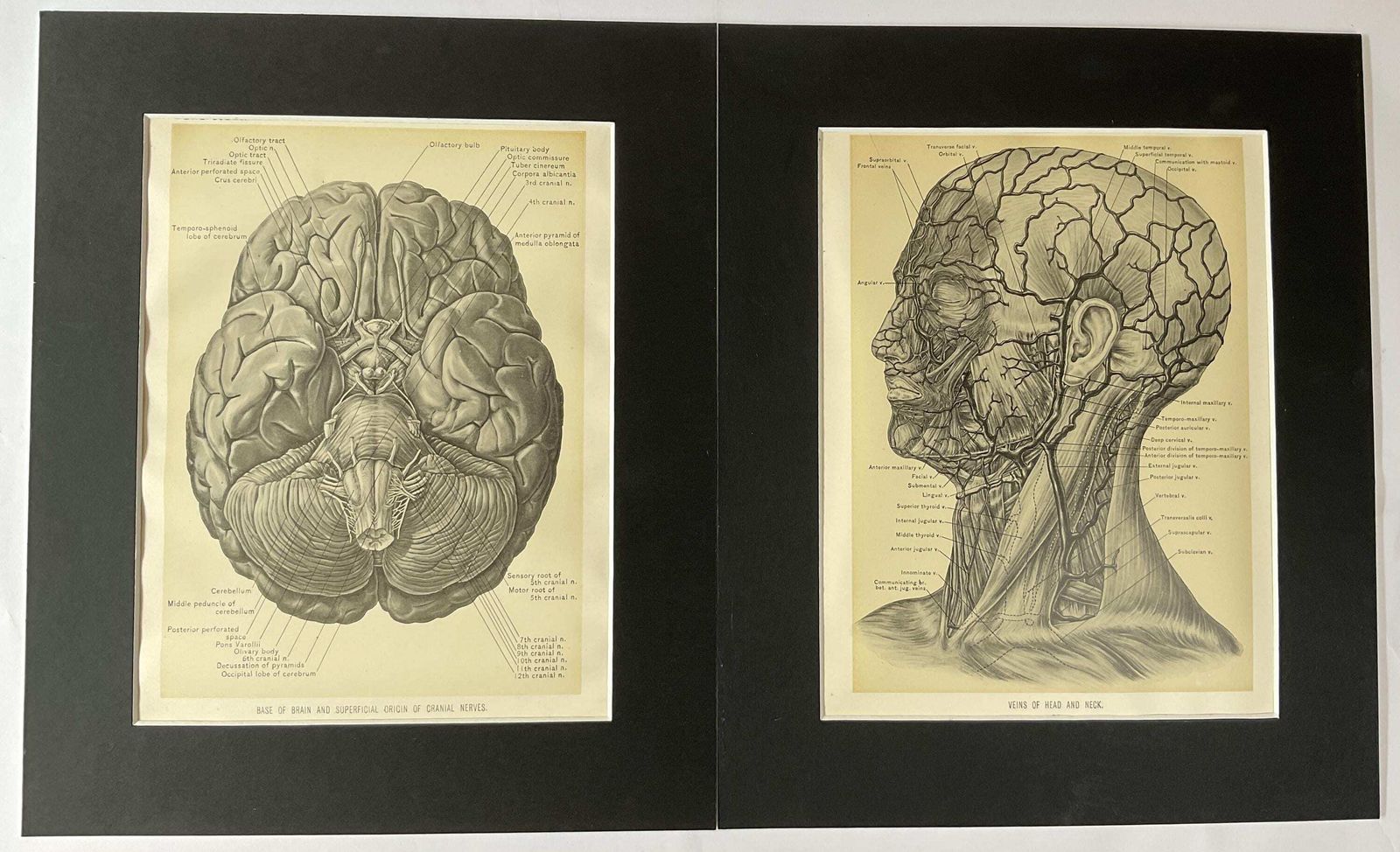 Antieke anatomische gravures uit 1900. Wanddecoratie. photo Kunst