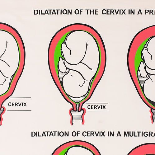 "Dilation Of The Cervix..." Adam Rouilly Medical Wall Chart photo Art