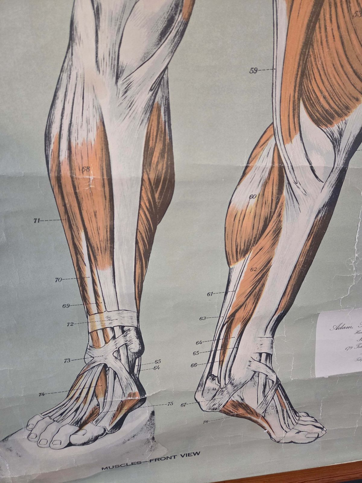 Art American Frohse Anatomical Chart Max Brodel Wall Hanging Poster By Adam, Rouilly & Co Medical photo
