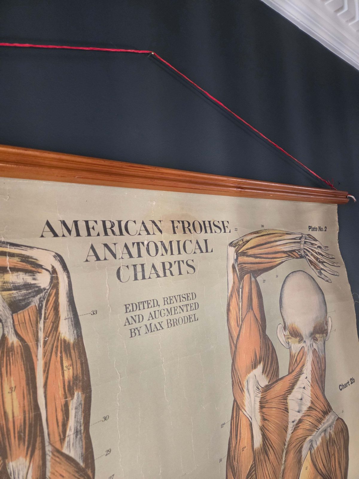 595.0 American Frohse Anatomical Chart Max Brodel Wall Hanging Poster By Adam, Rouilly & Co Medical photo