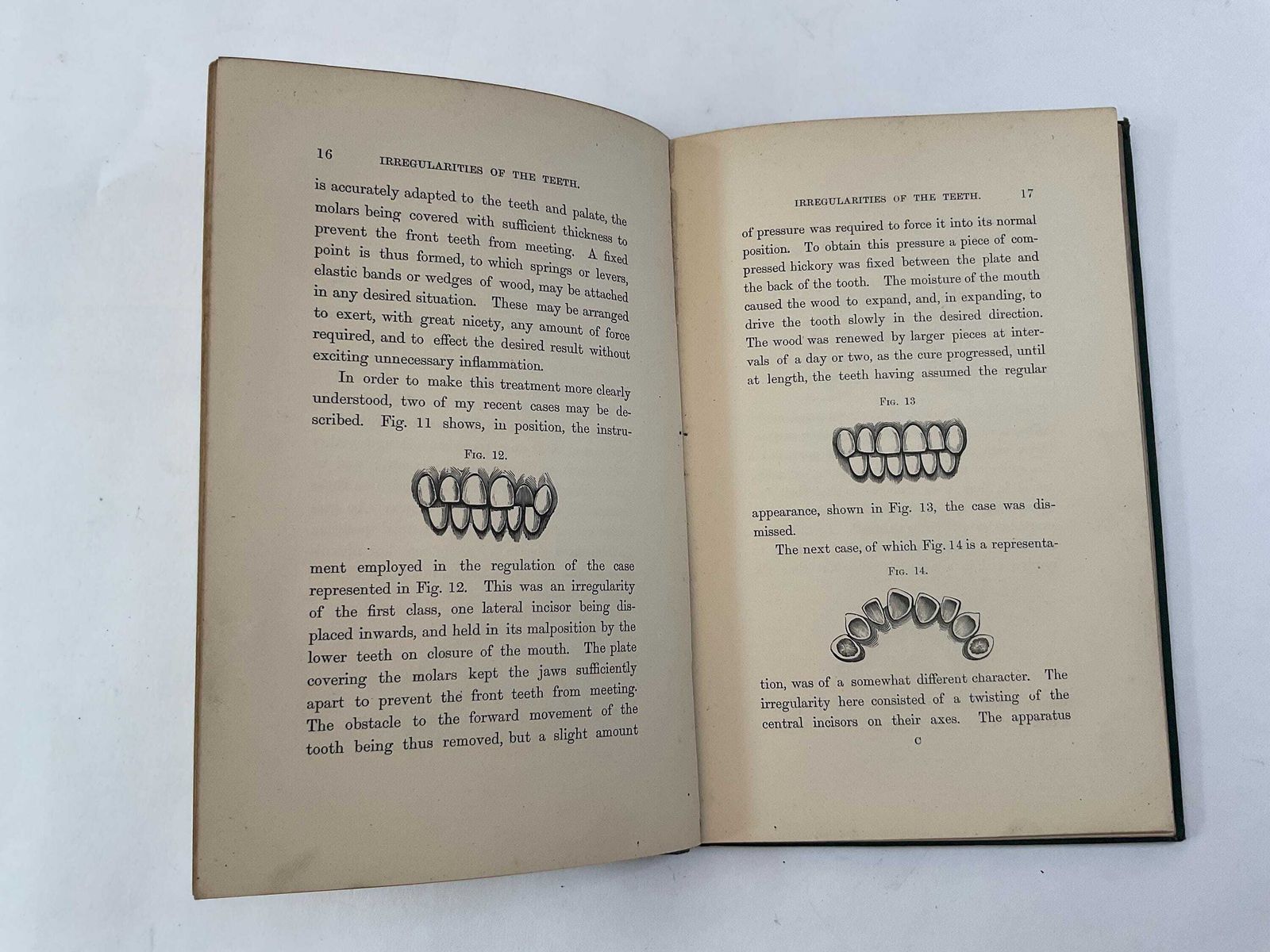 Antique 1870 Dental Book: Irregularities And Diseases Of The Teeth By Henry Sewill Victorian Medical History & Dental Oddities Decor photo vintage