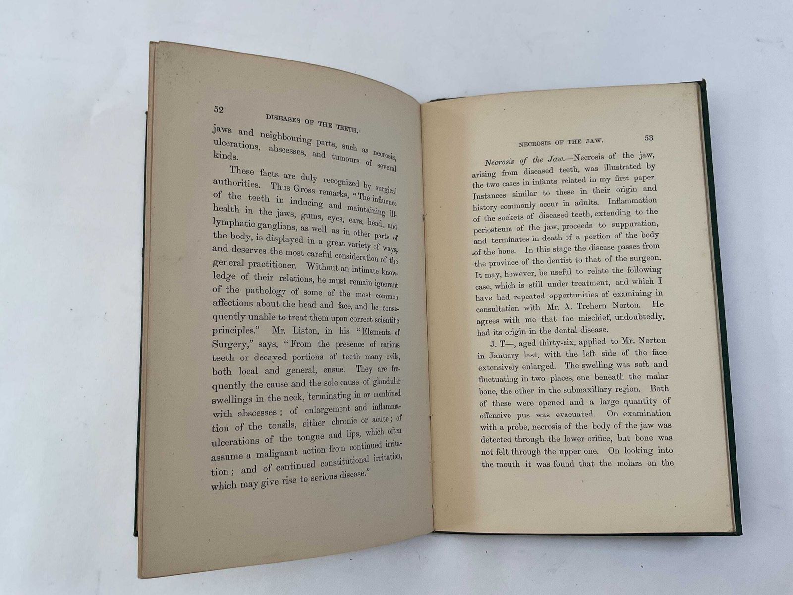 Woonaccessoires Antiek tandheelkundig boek uit 1870: Irregularities And Diseases Of The Teeth door Henry Sewill, Victoriaanse medische geschiedenis en tandheelkundige curiosa photo