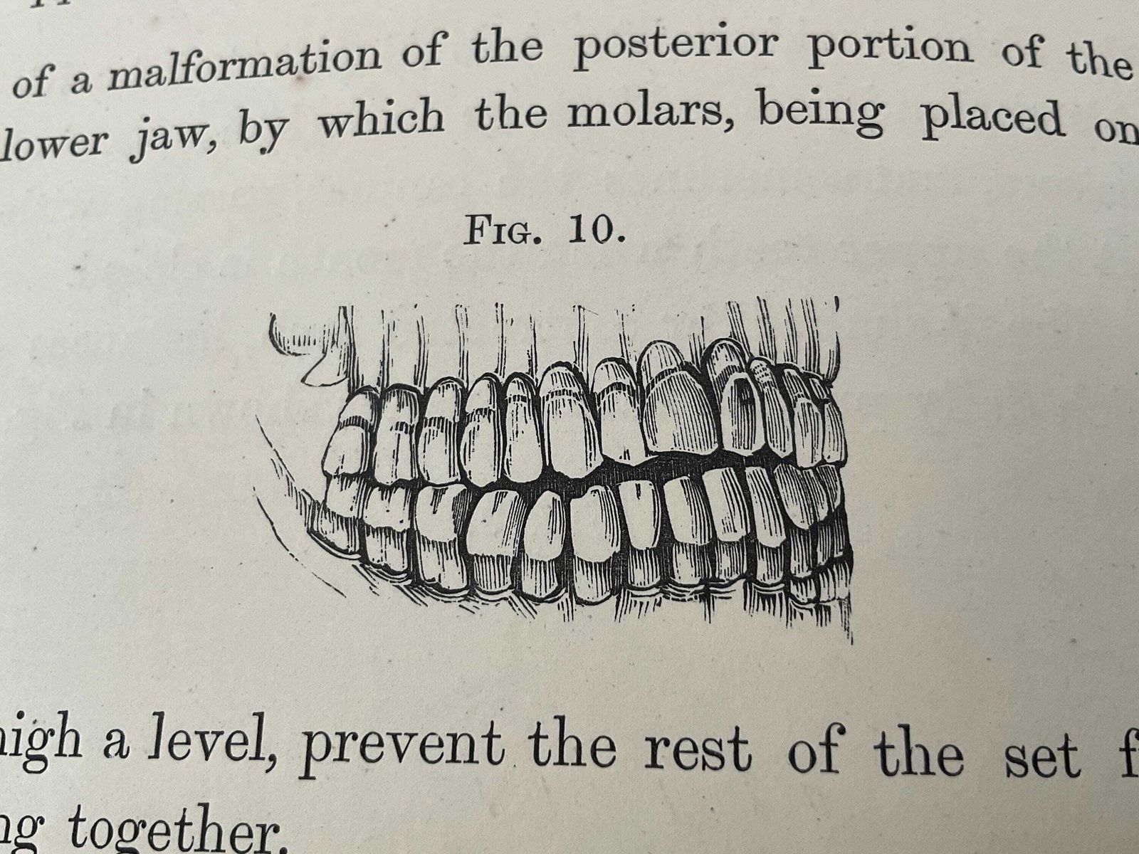 photo buy Antiek tandheelkundig boek uit 1870: Irregularities And Diseases Of The Teeth door Henry Sewill, Victoriaanse medische geschiedenis en tandheelkundige curiosa