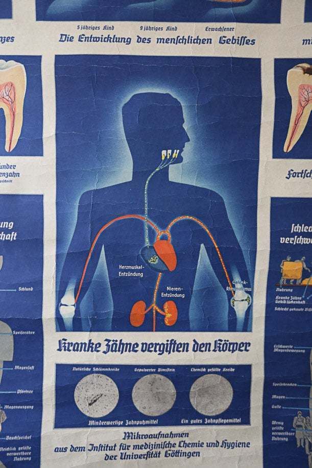 Original Anatomical Vintage Old German Educational School Wall Chart Teeth Dental Dentist Anatomy Medicine Beautiful Rare photo 150.0
